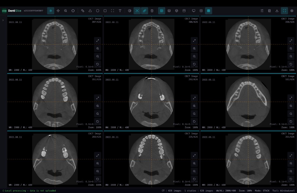 DentiSlice Stack view — 3×3 grid of axial CT slices