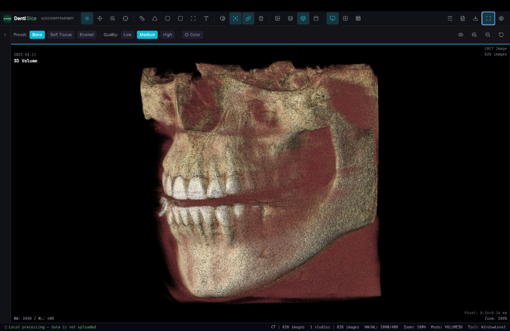 DentiSlice 3D Volume rendering — bone and soft tissue visualization